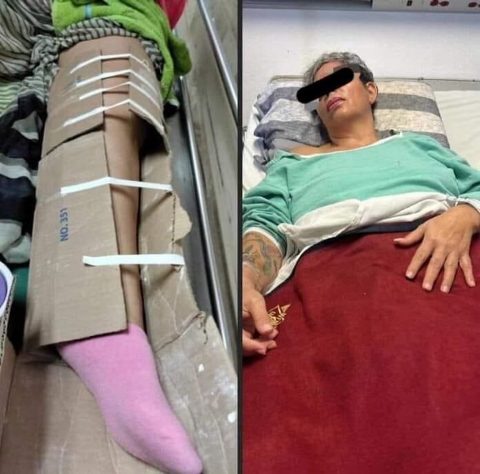 LE COLOCAN UN CARTÓN PARA INMOVILIZAR SU FRACTURA EN EL IMSS EN YUCATÁN